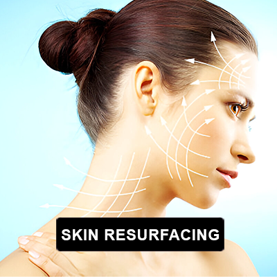 Skin Resurfacing