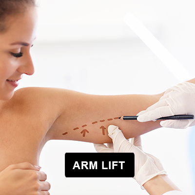 Arm Lift Surgery