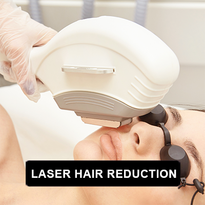 Laser Treatment
