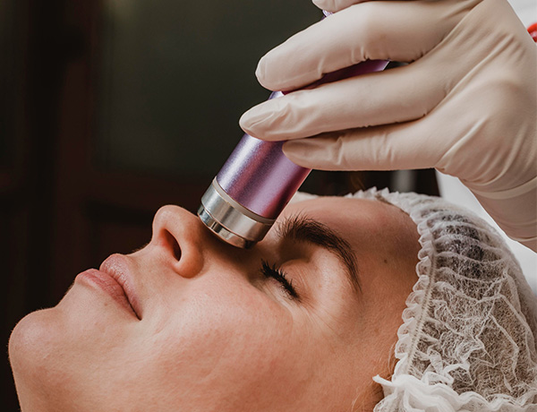 Microneedling Treatment in Gurgaon | Konarc Aesthetics